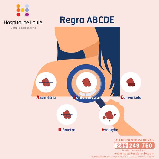 Com a chegada do verão ensinamos-lhe a identificar sinais suspeitos na pele com a regra ABCDE