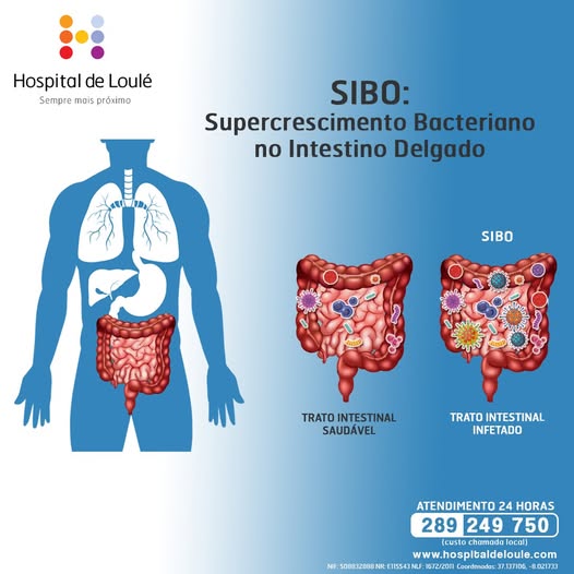 Have you ever heard of SIBO?